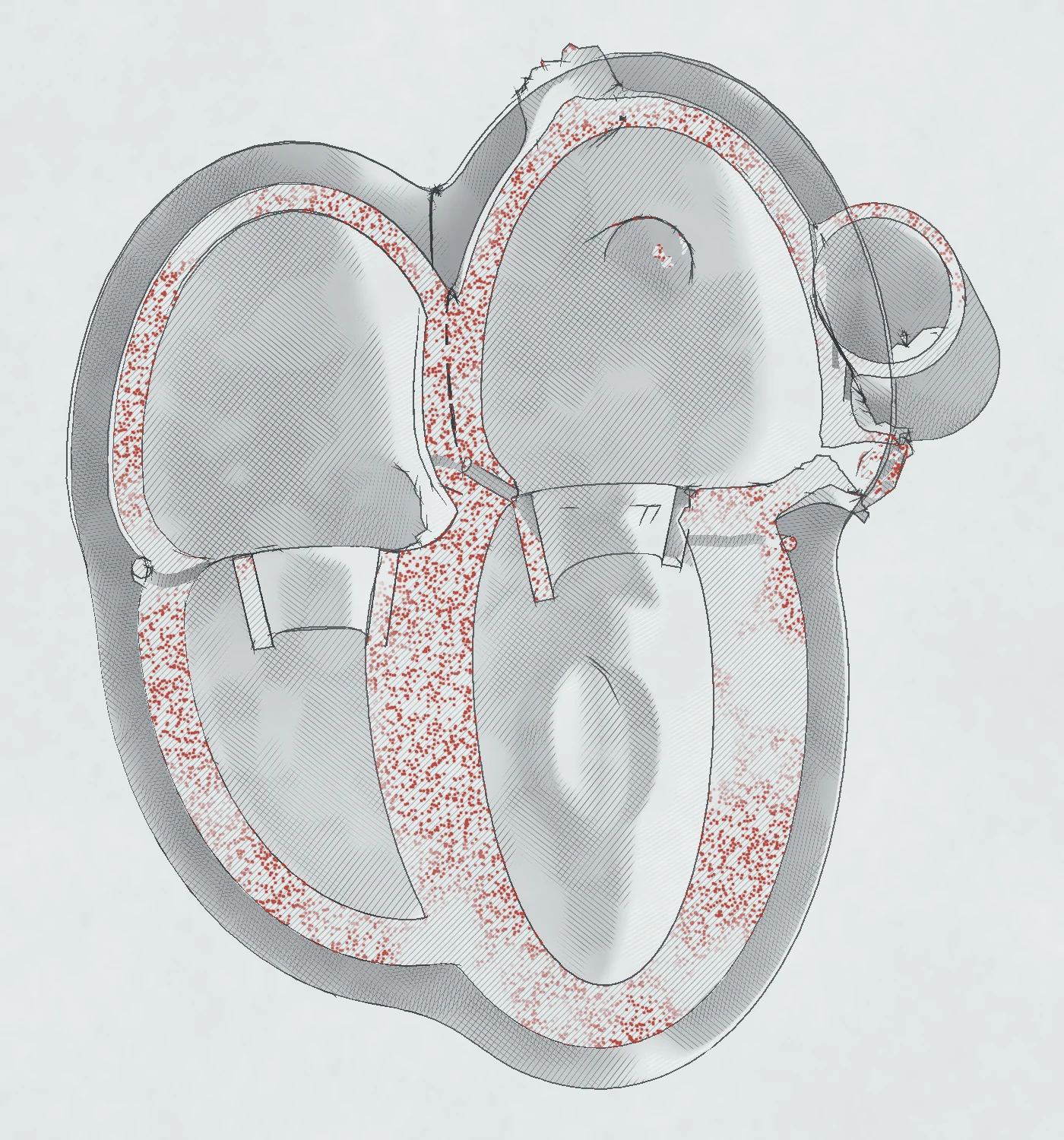 Four-chamber section of the amyloid model heart: thick walls stippled red, large atria and a wider pericardial space